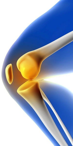 leg with knee pain 1